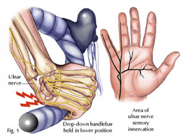 The Center for Minimally Invasive Neurosurgery